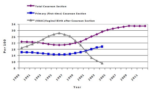 Are Doctors Over Reliant On Cesarean Sections The Becker Law Firm